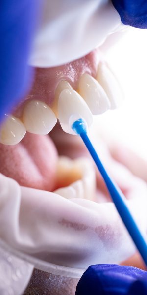 Advanced Dental Care-21